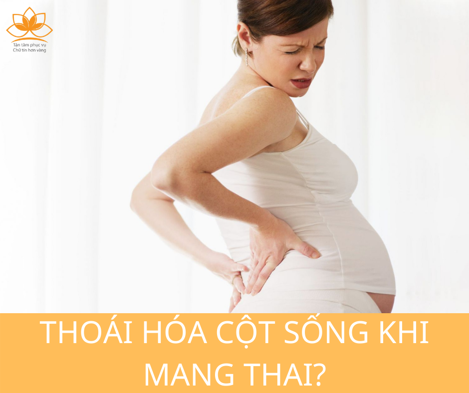 THOÁI HÓA CỘT SỐNG KHI MANG THAI